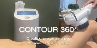 cryogénisation et laser diode focalisé avec palpé roulé mécanique avec aspiration et infra rouge