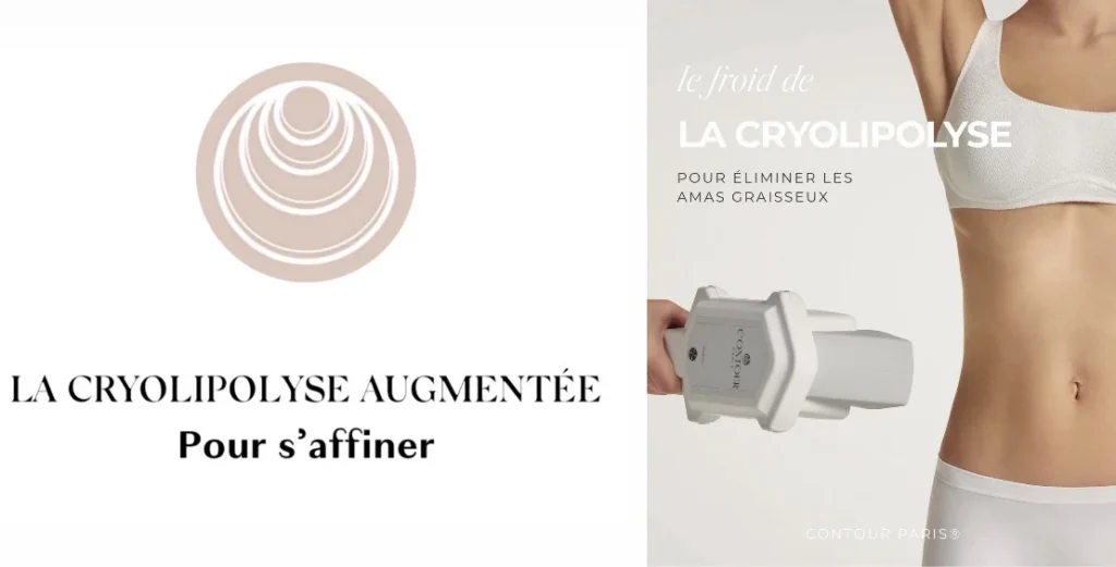 Visuel Contour Paris : la cryolipolyse augmentée pour s’affiner, applicateur présenté près de la taille
