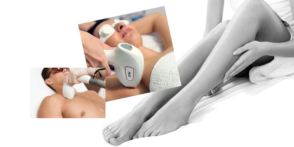 Épilation au laser diode pour les femmes et les hommes : torse, aisselles et jambes