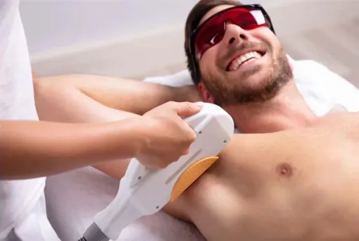 Épilation au laser diode des aisselles d’un homme