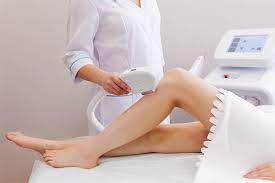 Appareil laser Kéros pendant une épilation des jambes
