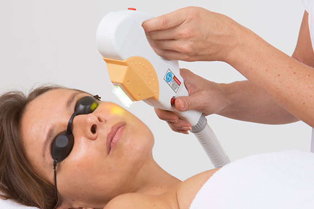 Séance de lumière pulsée sur le visage, lunettes de protection